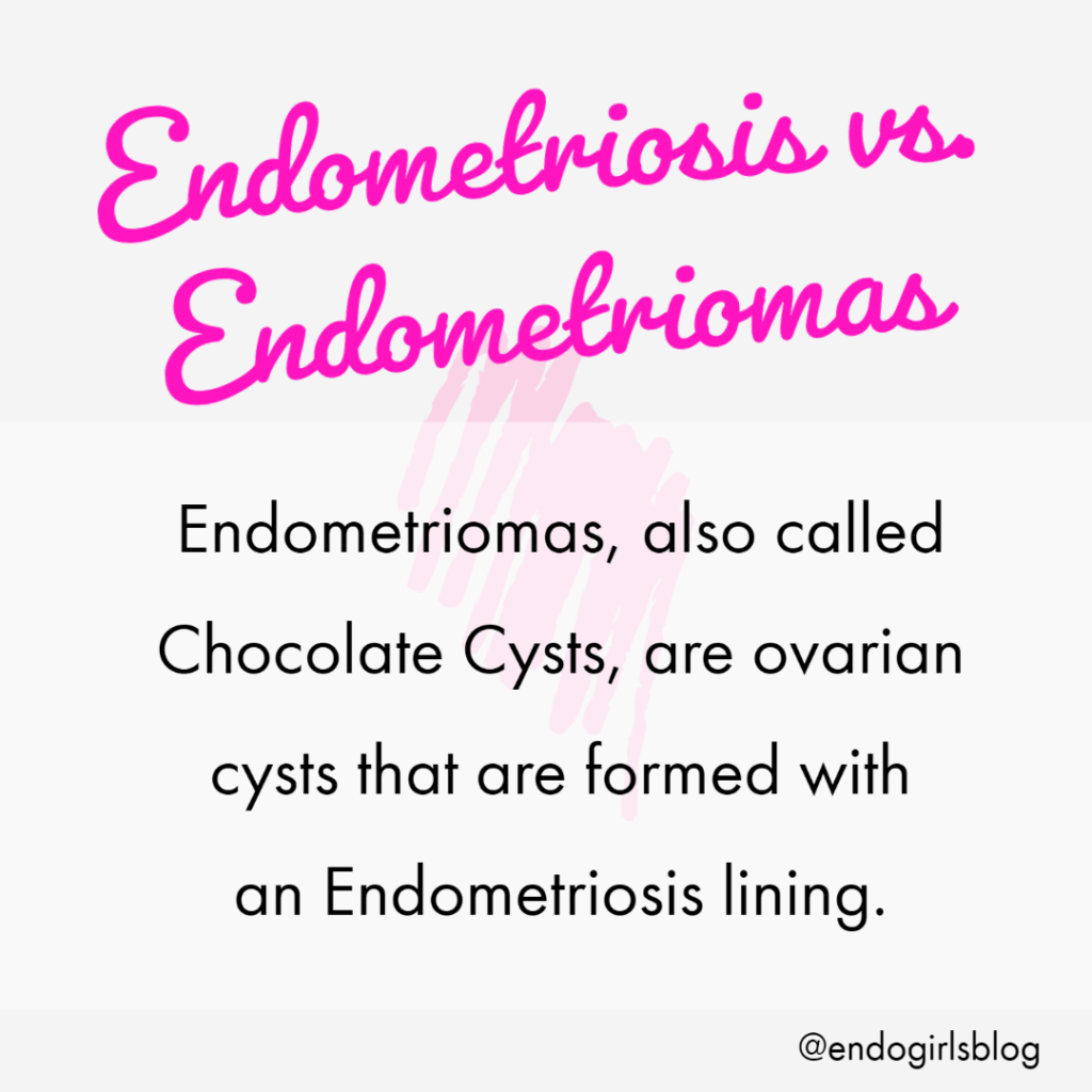 Graphic that describes an ovarian Endometrioma